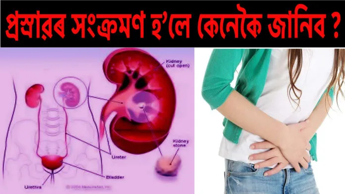 প্ৰস্ৰাৱ-সংক্ৰমণ-হ’লে-কেনেকৈ-জানিব