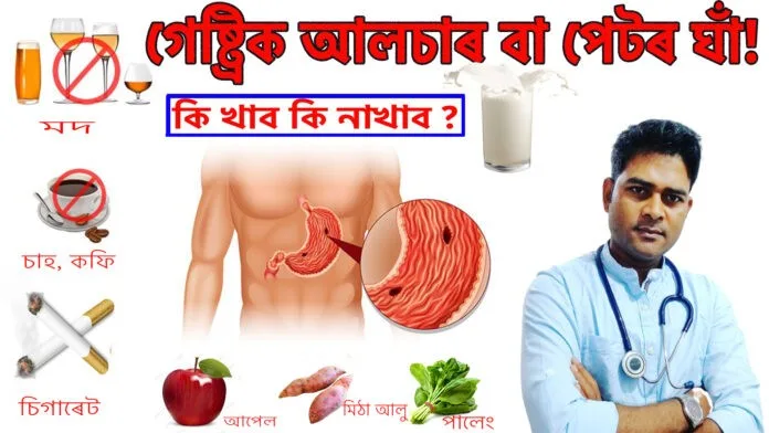 গেষ্ট্ৰিক-আলচাৰ