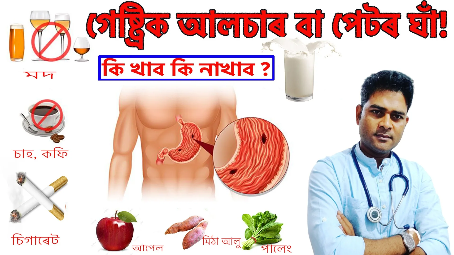 গেষ্ট্ৰিক-আলচাৰ